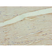 IHC-P analysis of Human skeletal muscle tissue, using CACNA2D1 antibody (1/100 dilution).