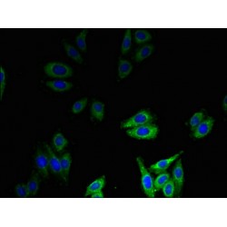 Beta-Defensin 1 (DEFB1) Antibody