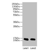 WB analysis of (1) Mouse Liver Tissue, and (2) Mouse Small Intestine Tissue, using FABP1 Antibody (16 µg/ml). Calculated MW: 15 kDa, Observed MW: 15 kDa.