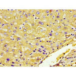 Haptoglobin Precursor / Zonulin (HP) Antibody