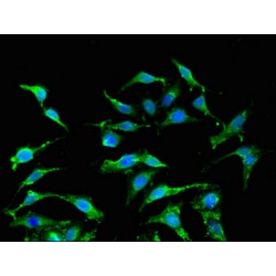 Interferon Alpha 2 (IFNA2) Antibody