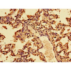 Interferon Alpha 2 (IFNA2) Antibody