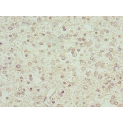 Interferon Alpha 2 (IFNA2) Antibody