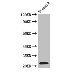 Interferon Alpha 2 (IFNA2) Antibody