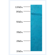 Leukocyte Immunoglobulin Like Receptor Subfamily B, Member 3 (LILRB3) Antibody