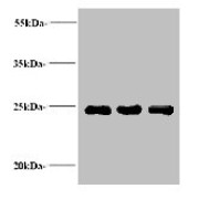 Western blot analysis of positive serum at (1) 1/10 dilution, (2) 1/100 dilution, and (3) 1/500 dilution, using NGAL antibody (2 µg/ml) and Goat anti-Rabbit IgG polyclonal antibody (1/15000 dilution).