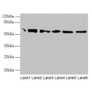 WB analysis of (1) Mouse Brain Tissue, (2) Colo320 whole cell lysate, (3) HepG2 whole cell lysate, (4) 293T whole cell lysate, (5) Hela whole cell lysate, and (6) MCF-7 whole cell lysate, using P4HB antibody (1.8 µg/ml) and goat anti-rabbit IgG secondary antibody (1/10000 dilution). Predicted band size: 58 kDa, observed band size: 58 kDa.