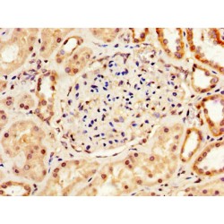 Lysyl Oxidase (LOX) Antibody