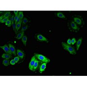 IF analysis of HepG2 cells, using RYR1 antibody (1/100 dilution) and AF488-conjugated Goat anti-Rabbit secondary antibody.