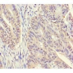 Spermidine Synthase (SRM) Antibody