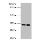 WB analysis of EC109 (Lane 1) and 293T (Lane 2) whole cell lysate, using SRM antibody (2 µg/ml). Predicted band size: 34 kDa. Observed band size: 34 kDa.