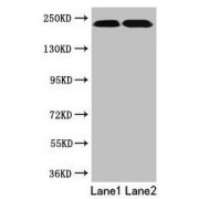 Western blot analysis of extracts of HeLa whole cell lysate (Lane 1) and Jurkat whole cell lysate using TLN2 antibody (12 µg/ml). Predicted band size: 272 kDa and Observed band size: 230 kDa.