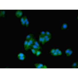 Transcription Factor BTF3 (BTF3) Antibody