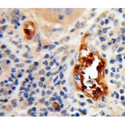 BTB And CNC Homolog 1 (BACH1) Antibody