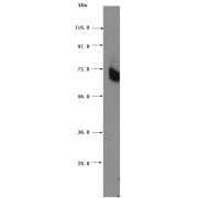 WB analysis of HeLa cells, using PAPOLB antibody (1/1500 dilution, 1.5 hrs at RT).