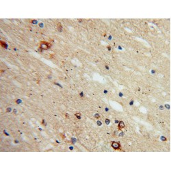 Phosphatidylinositol-3-Phosphatase SAC1 (SACM1L) Antibody