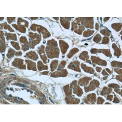 Phosphatidylinositol-3-Phosphatase SAC1 (SACM1L) Antibody