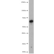 Phosphatidylinositol-3-Phosphatase SAC1 (SACM1L) Antibody