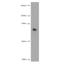 Phosphatidylinositol-3-Phosphatase SAC1 (SACM1L) Antibody