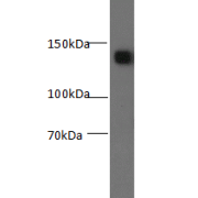 Western blot analysis of mouse brain tissue, using Syngap1 Antibody at a dilution of 1/500.