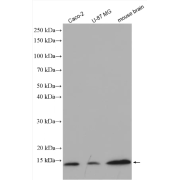 WB analysis of various cell lysates, using UBL3 antibody (1/1000 dilution, incubated for 1.5 hours at room temperature).