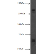 Western blot analysis of MCF7 cells subjected to SDS-PAGE, with Very Low Density Lipoprotein Receptor Antibody (dilution 1:300).