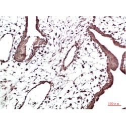 Chromobox Protein Homolog 3 (CBX3) Antibody