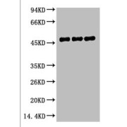 Western blot analysis of Mouse Brain Tissue and Rat Brain tissue using FH Antibody (1/2000 dilution).