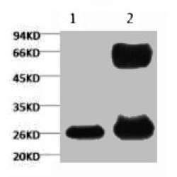 Green Fluorescent Protein (GFP) Antibody