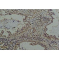 Phosphoserine Antibody