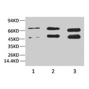 Western blot analysis of HeLa cell lysates (Lane 1), Rat Brain (Lane 2) and Mouse Brain (Lane 3) tissue using Phosphoserine Antibody (1/2000 dilution).