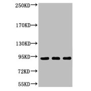 Western blot analysis of 1) Hela, 2) Jurkat, 3) HepG2, diluted at 1/2000.