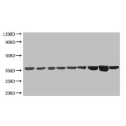 All Lanes: Mouse anti-GAPDH Monoclonal antibody at 1 µg/ml<br />Lane 1: A549 whole cell lysate<br />Lane 2: HT-29 whole cell lysate<br />Lane 3: Jurkat whole cell lysate<br />Lane 4: U251 whole cell lysate<br />Lane 5: COLO205 whole cell lysate<br />Lane 6: MCF7 whole cell lysate<br />Lane 7: K562 whole cell lysate<br />Lane 8: Hela whole cell lysate<br />Lane 9: 293T whole cell lysate<br />Secondary<br />Goat polyclonal to Mouse IgG at 1/5000 dilution<br />Predicted band size: 36 kDa<br />Observed band size: 36 kDa