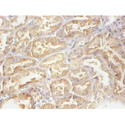 Retinol-Binding Protein 4 (RBP4) Antibody