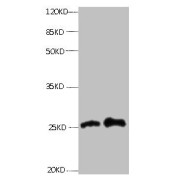 All lanes: Mouse anti- human Retinol-binding protein 4 monoclonal antibody at 0.3 µg/ml<br /> Lane 1: Human positive serum1: 10<br /> Lane 2: Human positive serum1: 100<br /> Secondary: HRP labeled Goat polyclonal to Mouse IgG at 1/3000 dilution<br /> Predicted band size: 23kd<br /> Observed band size: 27kd<br />