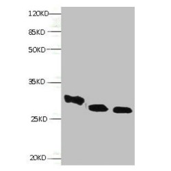 Retinol-Binding Protein 4 (RBP4) Antibody