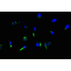 Nestin (NES) Antibody