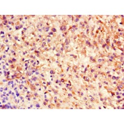 Nestin (NES) Antibody