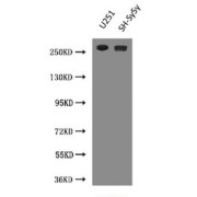 Western Blot <br /> Positive WB detected in: U251 whole cell lysate, SH-Sy5y whole cell lysate <br /> All lanes: NES antibody at 3 µg/ml<br /> Predicted band size: 260 kDa <br /> Observed band size: 260 kDa <br /> 