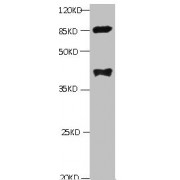 All lanes: Mouse anti-human Platelet-activating factor acetylhydrolase monoclonal Antibody at 1 µg/ml<br /> Lane 1: mouse spleen tissue<br /> Secondary: HRP labeled Goat polyclonal to Mouse IgG at 1/3000 dilution<br /> Predicted band size: 48kd<br /> Observed band size: 44kd<br /> Additional bands at: 85kd<br />