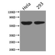 Western Blot<br /> Positive WB detected in: Hela whole cell lysate, HEK293 whole cell lysate<br /> All lanes: PODXL antibody at 2.5 µg/ml<br /> Secondary<br /> Goat polyclonal to Mouse IgG at 1/5000 dilution<br /> Predicted band size: 59, 56 kDa<br /> Observed band size: 59 kDa<br />