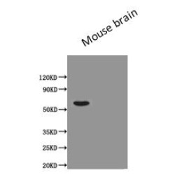 Podocalyxin (PODXL) Antibody