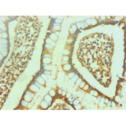 Gamma-Enolase (ENO2) Antibody