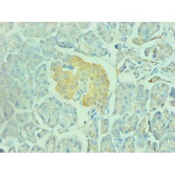 Gamma-Enolase (ENO2) Antibody