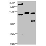 WB analysis of (1) HeLa cell lysate, (2) recombinant ENO2, and (3) U251 cell lysate, using ENO2 antibody. Calculated MW: 43, 48 kDa, Observed MW: 48 kDa + additional band at 100 kDa.