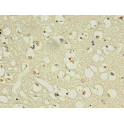 Immunohistochemistry analysis of paraffin-embedded human brain using NPPB Antibody in 30 µg/ml dilute concentrations.