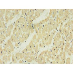 Natriuretic Peptides B (NPPB) Antibody