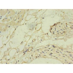 Natriuretic Peptides B (NPPB) Antibody