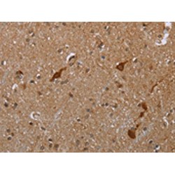 Caspase 8 Associated Protein 2 (CASP8AP2) Antibody