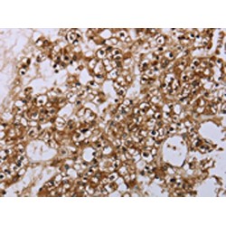 Caspase 8 Associated Protein 2 (CASP8AP2) Antibody